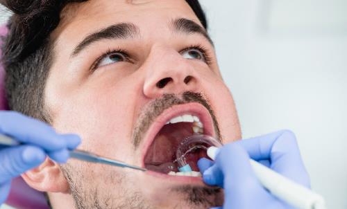 为了美白反而伤害牙齿?洗牙不是你想得那样!